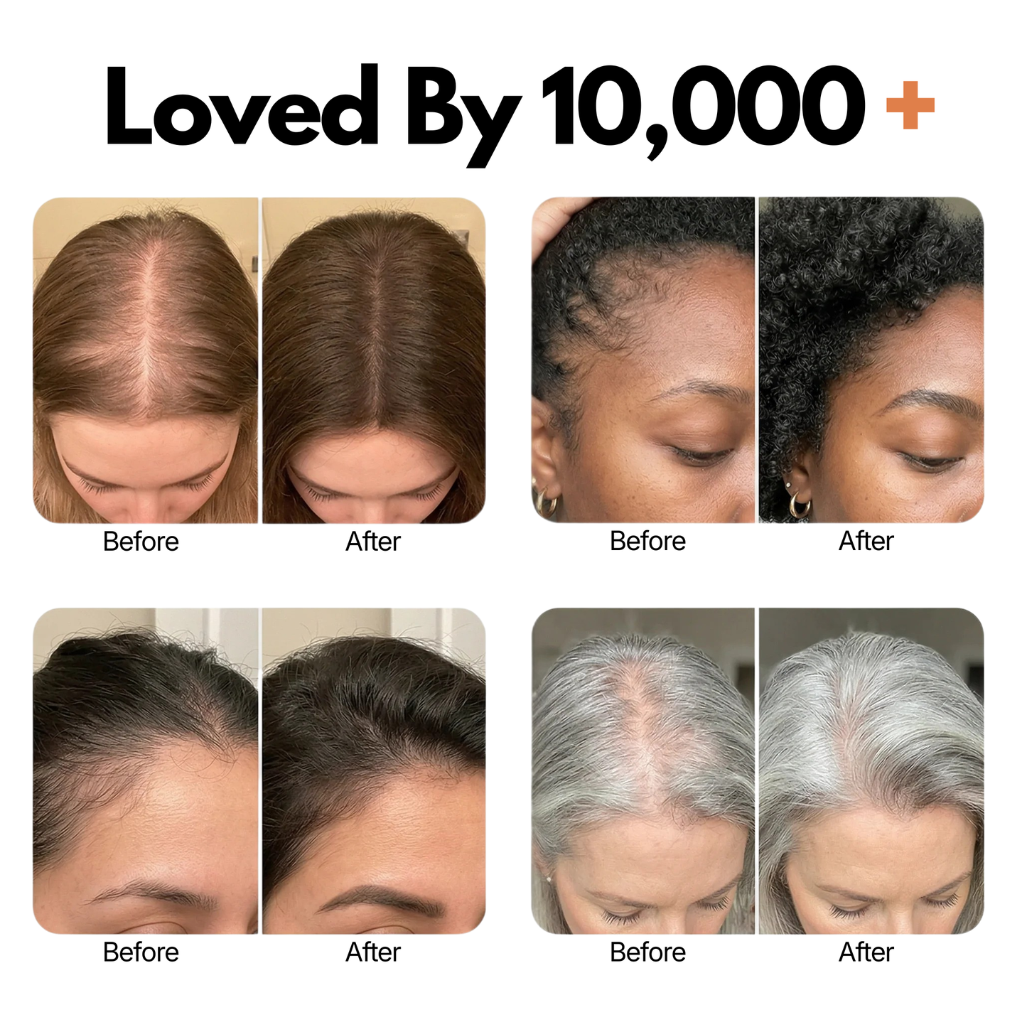 Belaria Hair Growth Serum