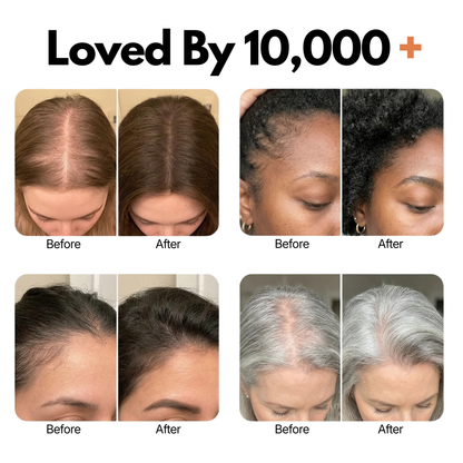 Belaria Hair Growth Serum