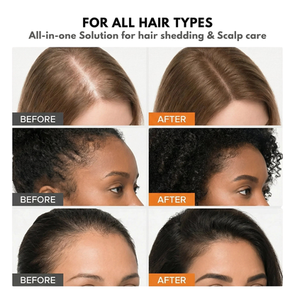 Belaria Hair Growth Serum